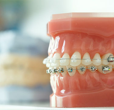 矯正歯科