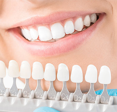 審美的歯科治療